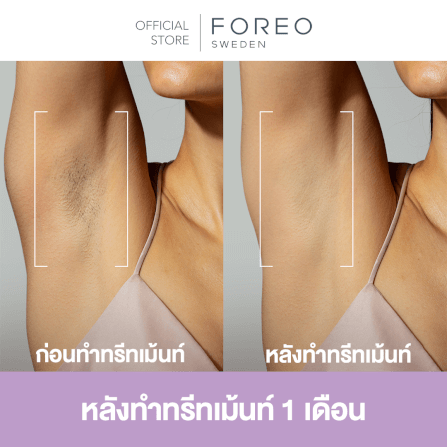 เครื่องกำจัดขน IPL FOREO PEACH 2 GO Peach_7
